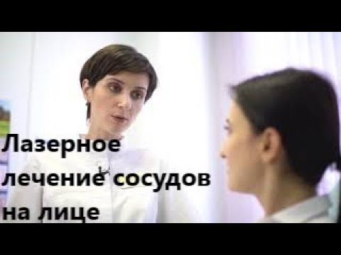 Лазерное лечение сосудистых звездочек и купероза на лице.