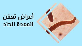 أهم أعراض تعفن المعدة الحاد