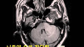Do neurology clinic test blink reflex