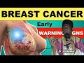 Dr Salihannur Maganin Ciwon Daji Cancer Cancer Brest Tumores 