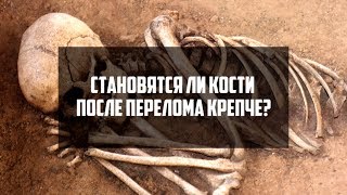 Становятся ли кости после перелома крепче? | DeeaFilm Становятся ли кости после перелома крепче? | DeeaFilm