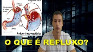 Gástrico fibromialgia e refluxo