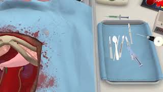 [Surgeon Simulator] How to get a A++ in Surgeon simulator (iPad) Kidney transplant screenshot 5