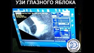УЗИ глаза у собаки. Доберман. УЗИ глаза у собаки. Доберман.