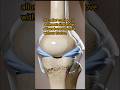 Osteoarthritis: When Joints Lose Their Cushion🦴
