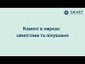 Лікування СКХ (каменів) | Київ