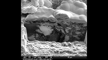 Focused ion beam microscopy