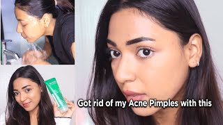 My Secret to Clear Skin: How I got rid of my Acnes/Pimples | Jovees Herbal Tea Tree Face Wash Review by Kareena Malik 664,264 views 3 months ago 3 minutes, 50 seconds