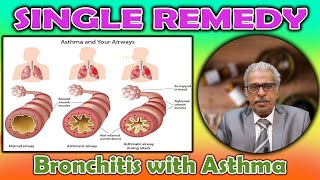 Single Remedy - Bronchitis with Asthma - Dr P.S. Tiwari