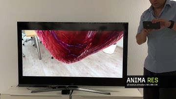 #MedicalEducation #AppleTV 3D Medical Animations Insight Heart @animares