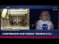 Neumonía en adultos mayores. Doctor Tardaglioni explica los riesgos y cuidados