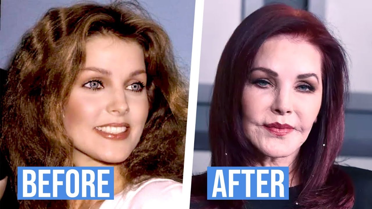 TOP 10 CELEBRITIES PLASTIC SURGERY DISASTERS
