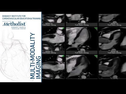 تناؤ MRI: طریقہ کار، موجودہ کردار، اور کیس اسٹڈیز (Eric Y. Yang, MD, PhD) اکتوبر 23، 2018