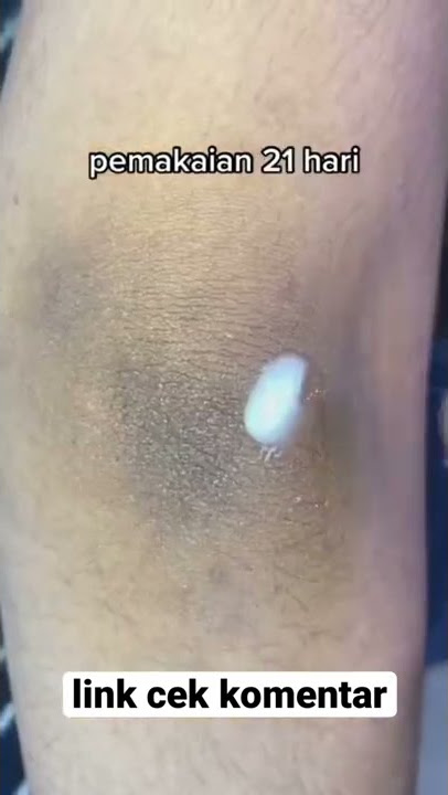 review pemakaian brighty underarm selama 1 minggu #shorts #skincare