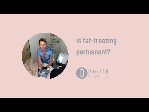 Is fat freezing or Coolsculpting™️ permanent?