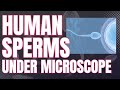 Human Sperms under Microscope | Sperms microscopic view  | Sperms under high power