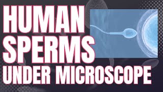 Human Sperms under Microscope | Sperms microscopic view  | Sperms under high power