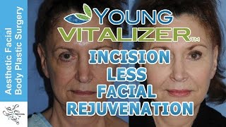 Seattle's YoungVitalizer - Incision Less Facial Rejuvenation. The Eye & Facelift with No Incisions