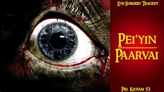 Download Lagu Peiyin Paarvai || Eye Surgery Tragedy || Pei Kathai No.53 MP3