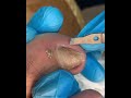 Satisfying Pedicure Routine | Gentle Toenail Care #fypシ #fypシ #pedicure #nailcare