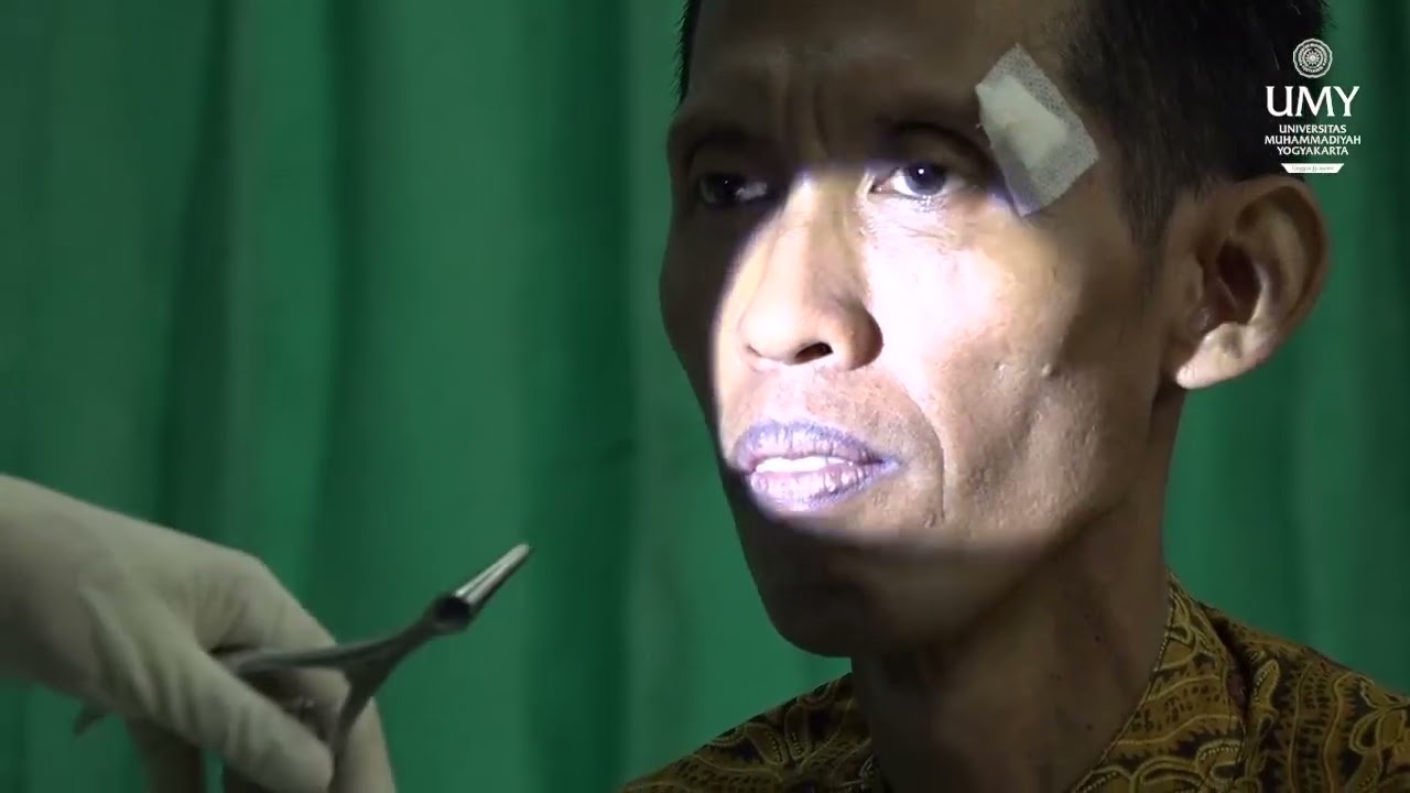 Skills Lab - Pemeriksaan THT 2