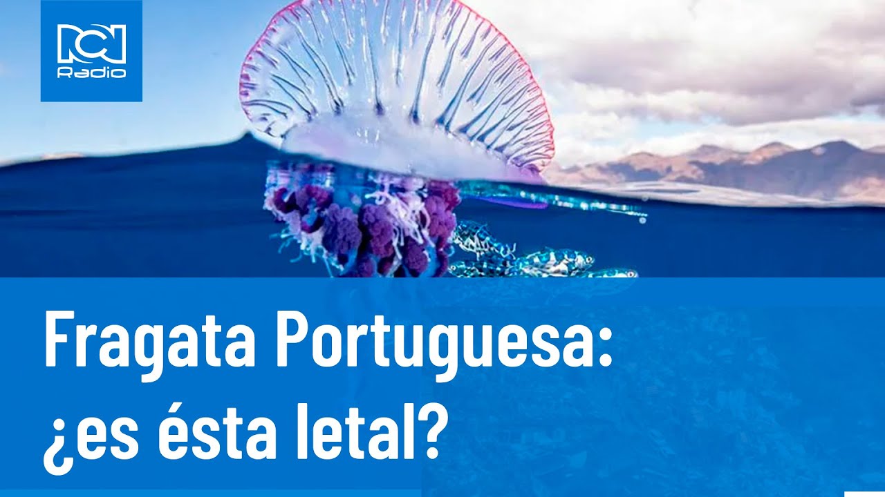 Fragata Portuguesa: ¿es letal su picadura? RCN Radio