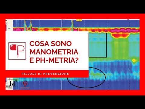 Vídeo: Per què es fa una manometria esofàgica?