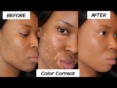 Color Correcting - How To Cover Under Eye Dark Circles and Acne scars