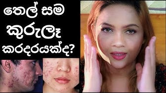 Sinhalaskincare Youtube