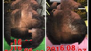 Itf연맹 두피관리사 교육 안내