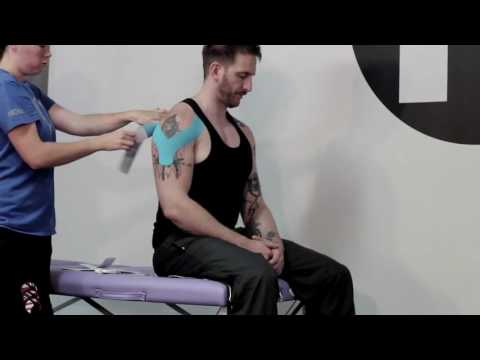 Kinesio Taping for Shoulder Injuries HD