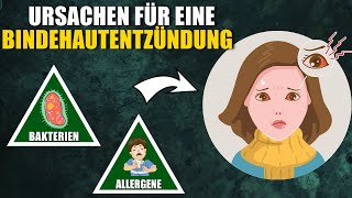 6 Ursachen für eine Bindehautentzündung (Konjunktivitis)