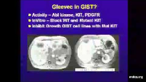 2014 MSKCC GIST Event