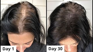 Apply Fenugreek Oil Daily & Turn Thin Hair to Thick Hair in 30 Days - Double Hair Growth & Long Hair