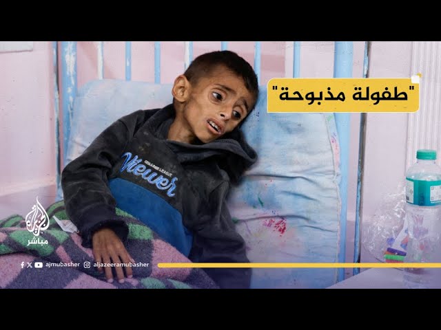 "هزال وضعف شديد".. الحصار يفتك بأطفال غزة
