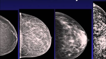 Introduction to Mammography