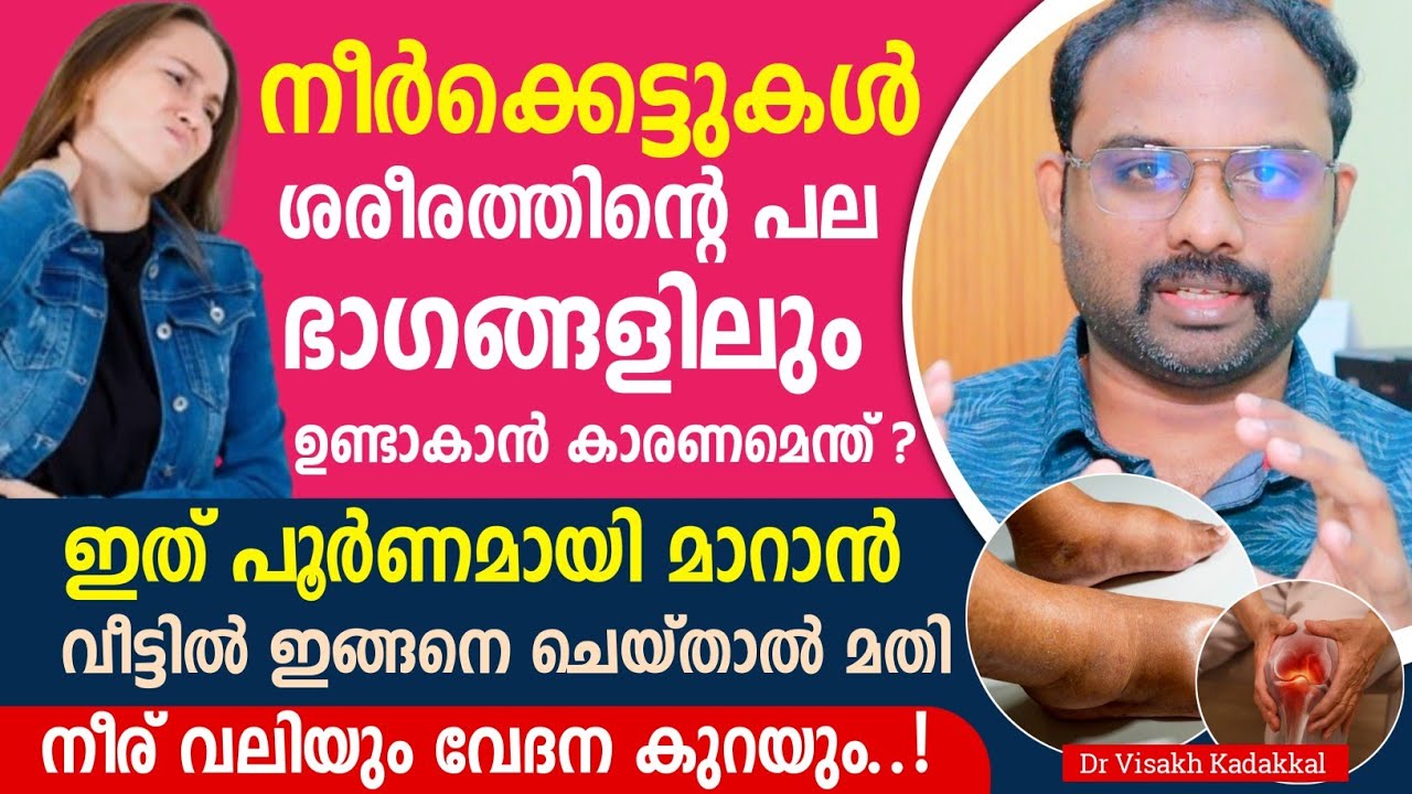 ശരീരത്തിൻ്റ പല ഭാഗത്തും നീർക്കെട്ട് ഉണ്ടാകാൻ കാരണം എന്ത് ? ഇത് എങ്ങനെ പൂർണമായി മാറ്റാം ? 