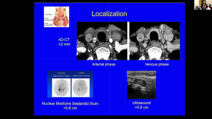 Disorders of Calcium Metabolism