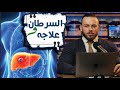 السرطان و علاجه كدرت اشفي والدي بهاي الطريقه بأذن الله الدكتور انطاه شهرين للعيش فقط 