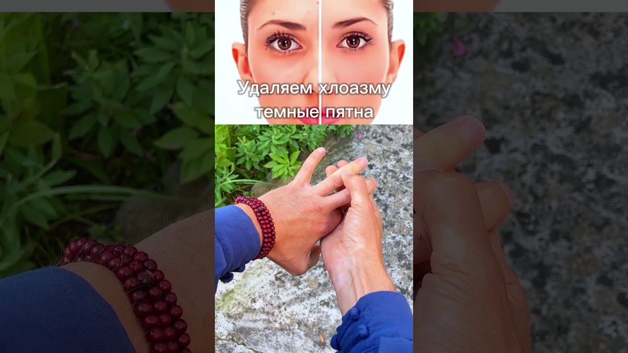 3 ТОЧКИ НА ПАЛЬЦЕ! Убираем темные пятна на лице 