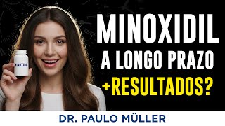 Usar Minoxidil por Longo Prazo - Mais Resultados? Descubra!