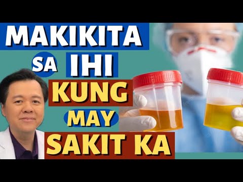 Makikita sa Ihi kung May Malalang Sakit - By Doc Willie Ong (Internist and Cardiologist)