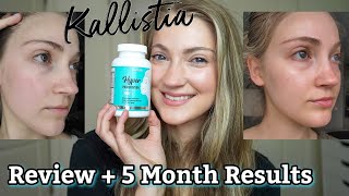 Kallistia Hyperpigmentation Cleanse Review & 5 Month Results