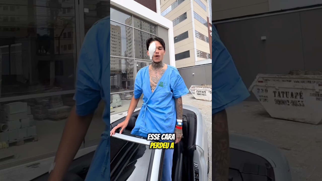 Big Boss perdeu a visão para defender a namorada…