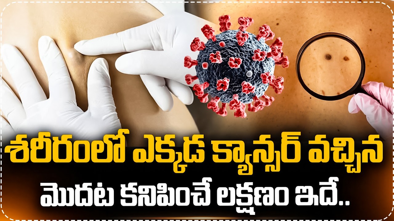 శరీరంలో ఎక్కడ క్యాన్సర్ వచ్చిన మొదట కనిపించే లక్షణం ఇదే..| Dr Sainath Abt Cancer Myths & Facts