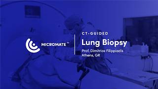 Micromate™ | CT-guided, Robotic-Assisted Lung Biopsy (Prof. Dimitrios Filippiadis)