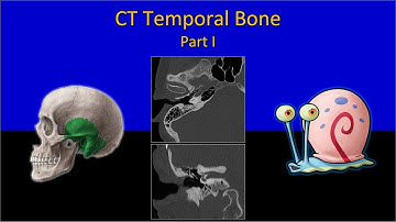 CT Temporal Bone Made Easy (Part 1) - Step by Step Approach