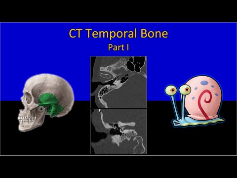 CT Temporal Bone Made Easy (Part 1) - Step by Step Approach