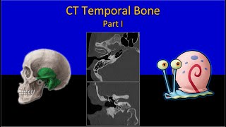 CT Temporal Bone Made Easy (Part 1) - Step by Step Approach screenshot 4