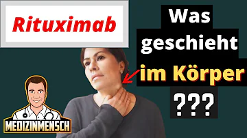 Ist Rituximab eine Chemo?